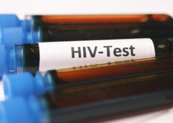 Ilustrasi HIV/AIDS. (Dok. Canva)